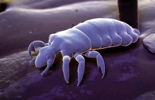 a-new-technology-kills-super-lice-without-chemicals
